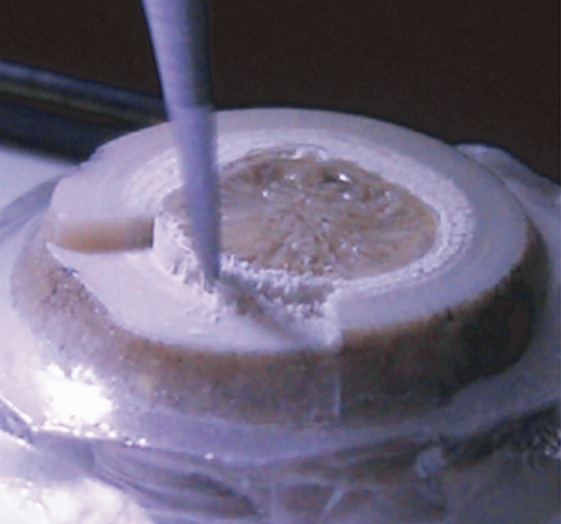 Automatic milling along growth lines
